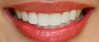 Прикус зубов: правильный и неправильный – виды, характеристики, фото